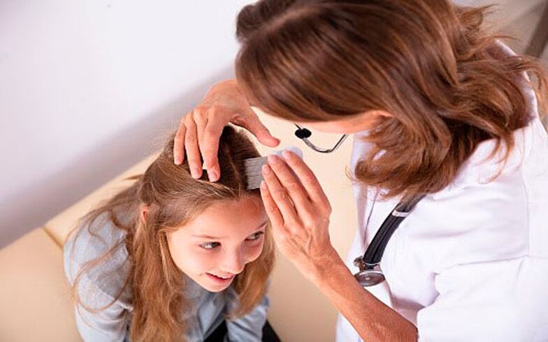 Tratamento da psoríase da cabeza en nenos